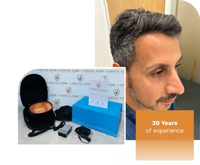Laser Therapy For Hair Loss