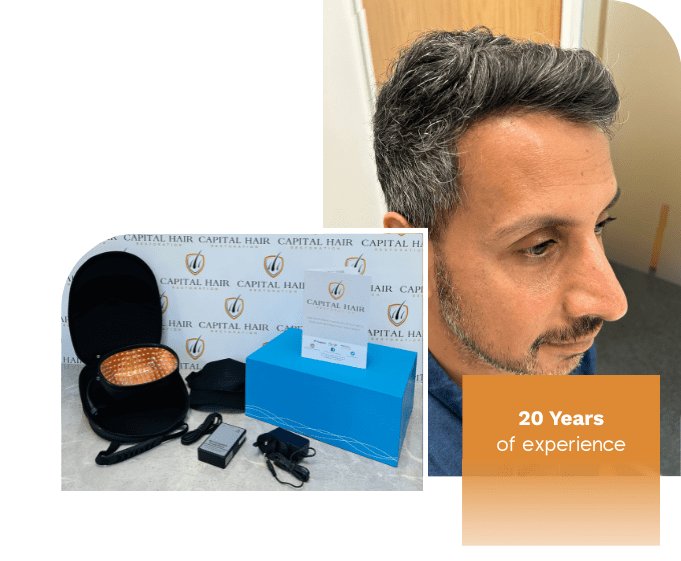 Laser Therapy For Hair Loss