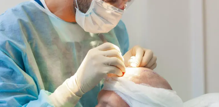 FUT and FUE hair transplant