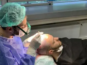Hair Transplants in London Optimal Results