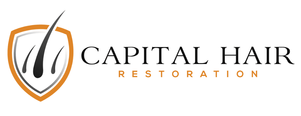 Capital-Hair-Restoration-01-copy new