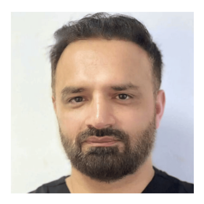 dr zabeeh ullah hair transplant surgeon